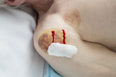 Similar image 22456888