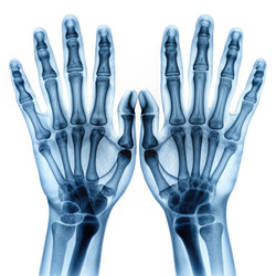 Similar image 22491695