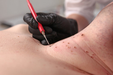 Similar image 22501931