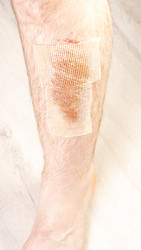 Similar image 22492530