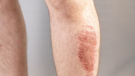 Similar image 22492548