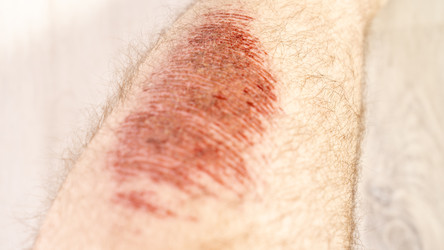 Similar image 22492568