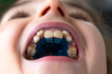 Similar image 22484044