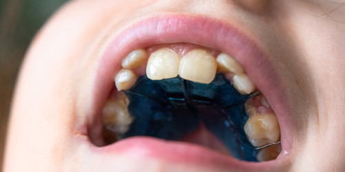 Similar image 22485198