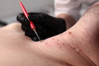 Similar image 22501858