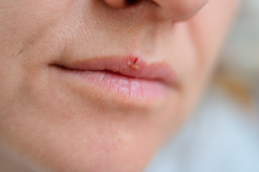 Similar image 22578417