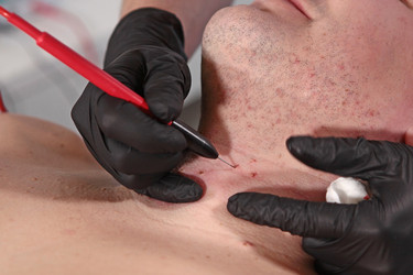 Similar image 22562050