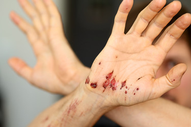 Similar image 22577308