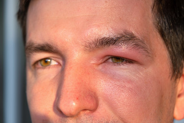 Similar image 22630046