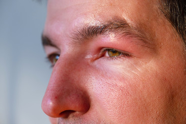 Similar image 22630061