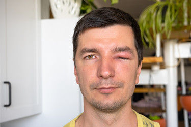 Similar image 22630135