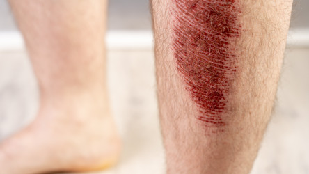 Similar image 22636847