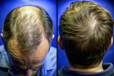 Similar image 22635999