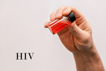 Лаборант держит пробирку. Медицинская проблема пандемии ВИЧ-вируса - Matroskin
