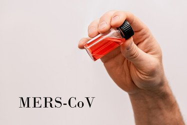 Лаборант держит пробирку. Медицинская проблема пандемии вируса MERS-CoV - Matroskin