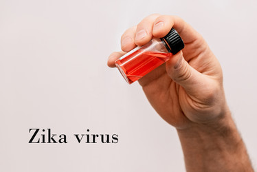 Лаборант держит пробирку, медицинская проблема пандемии вируса Зика - Matroskin