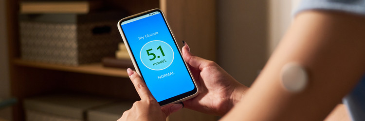 Девушка проверяет уровень глюкозы на смартфоне с непрерывным монитором - Pressmaster
