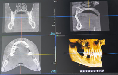 Интерфейс визуализации CBCT зубов с коронально-сагиттальным осевым обзором и 3D-сканированием челюсти. Стоматологический - Pazemin