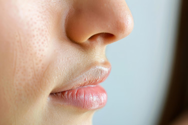 Close up of a woman's face highlighting dry, chapped lips - yliv