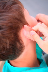Painful flaking and itching of skin behind ears of - paha_l